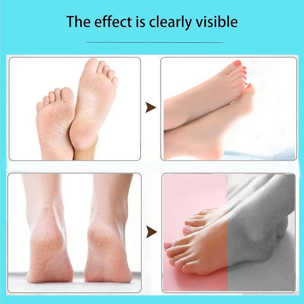Foot Callus Remover